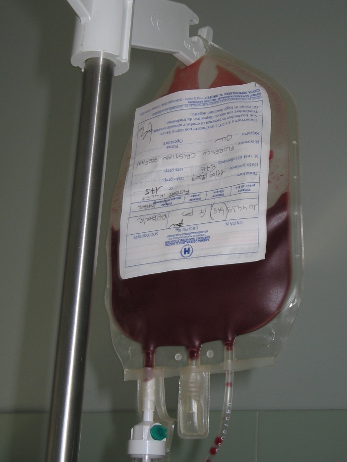 2unitatea de sange_prima transfuzie_15 09 2009